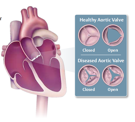 Vcs Heart To Heart – Patient Education Webinar - Virginia 